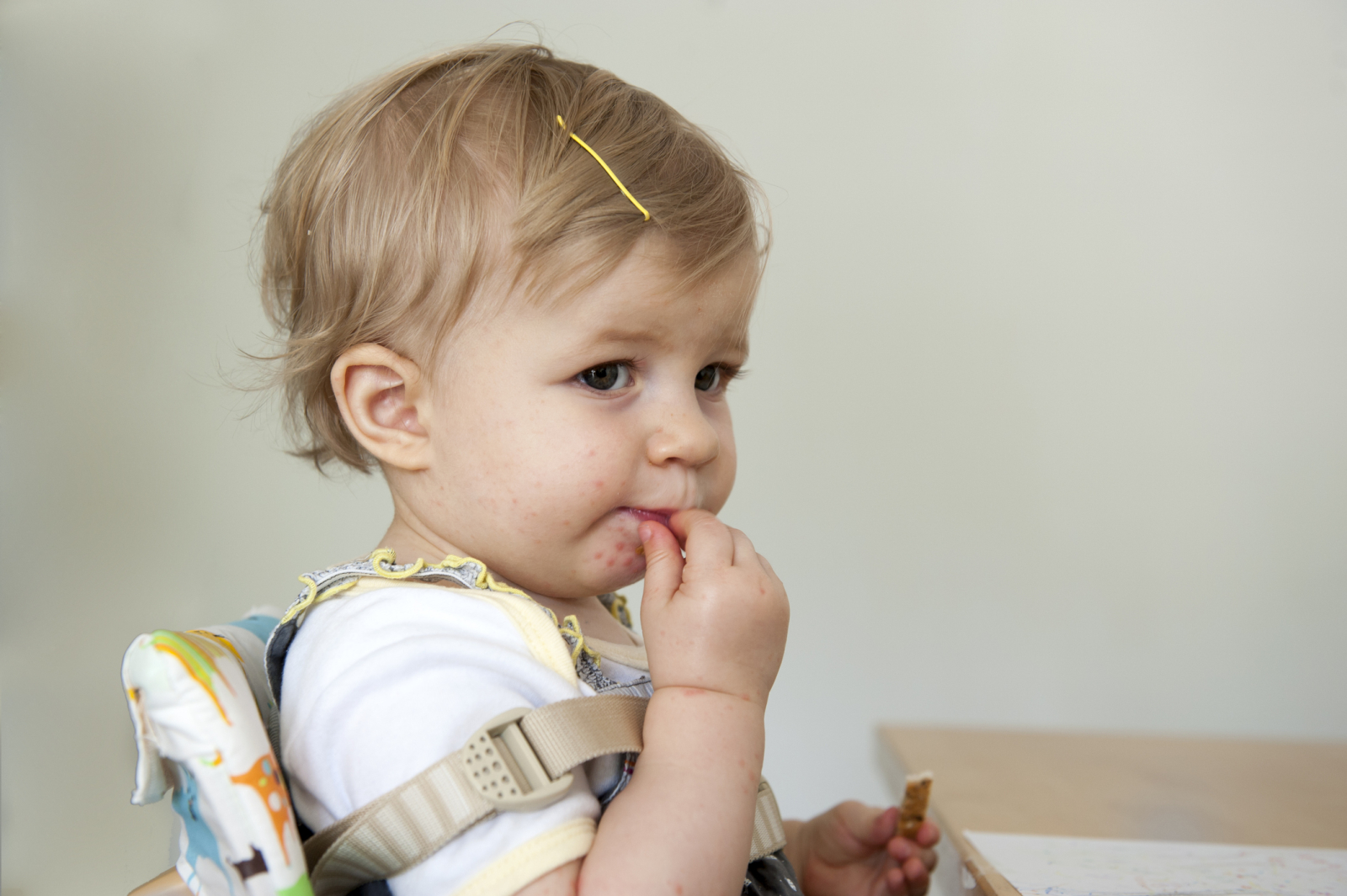 An infant sits in a high chair with their hand in their mouth. Their chin and mouth have a few red blisters, indicating potential symptoms of hand, foot, and mouth disease.