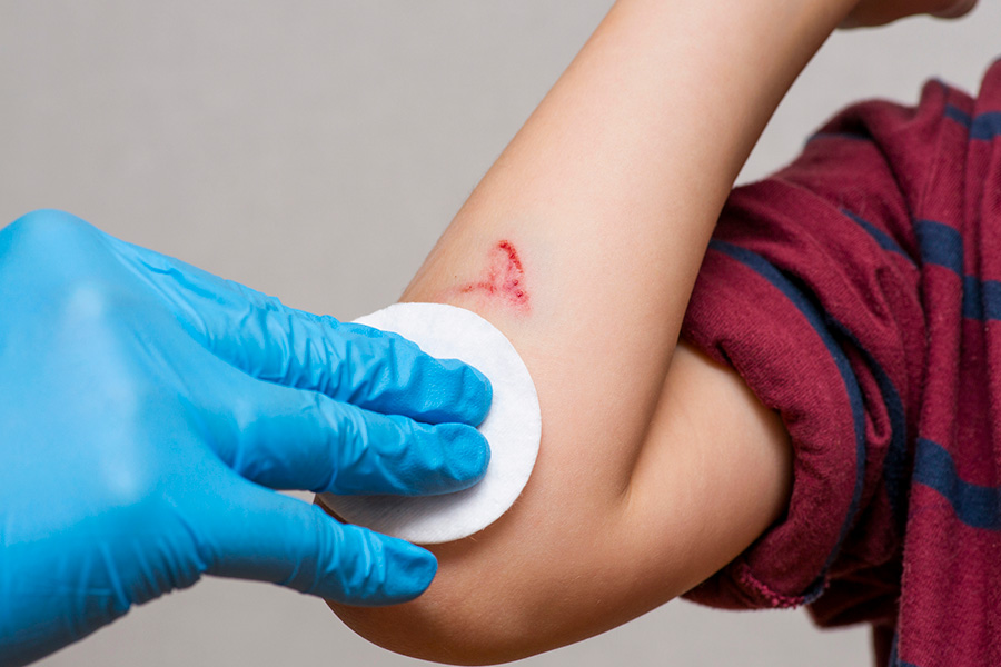 A nurse cleans a scrape on a child's arm